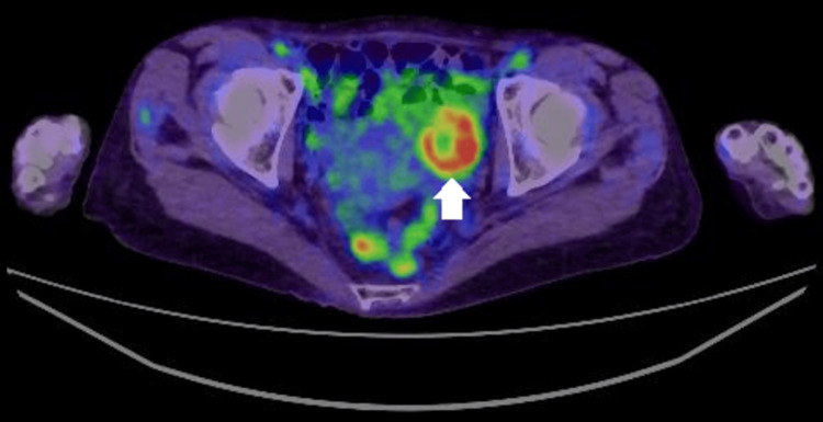 Figure 6