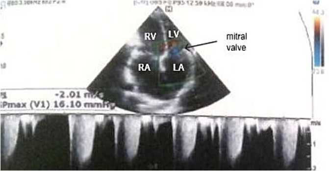 Figure 4