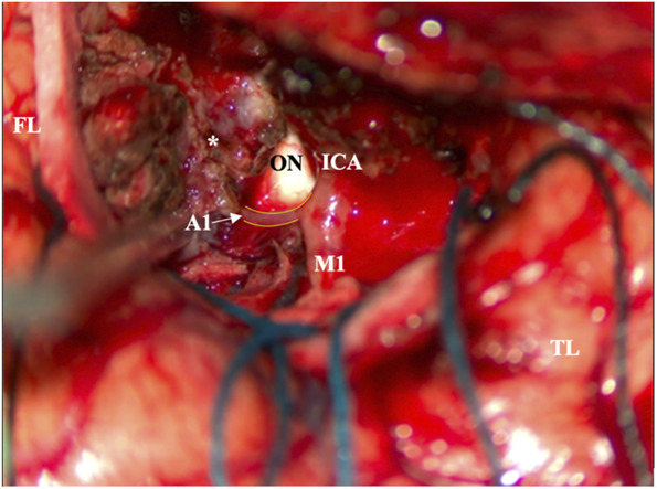 FIGURE 3