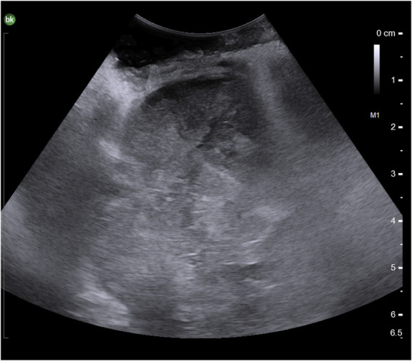 FIGURE 3