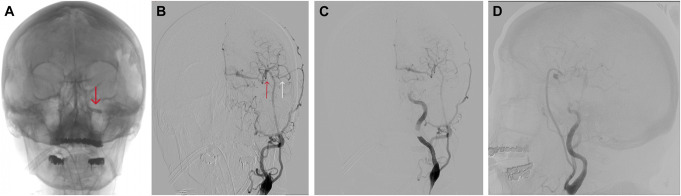 FIGURE 3