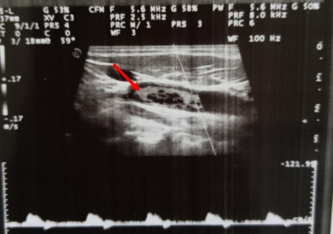 FIGURE 4