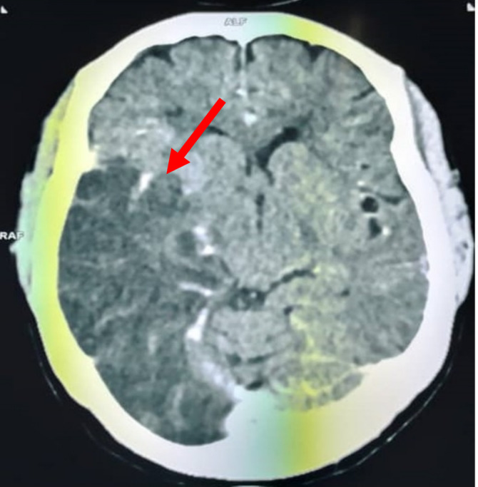 FIGURE 3