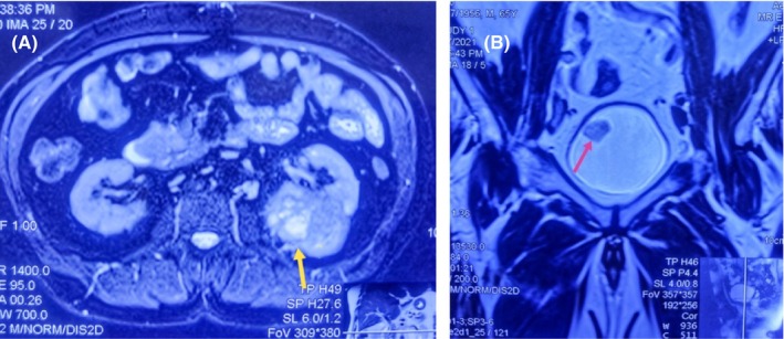 FIGURE 1