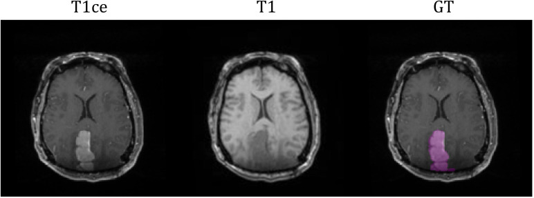 Figure 1