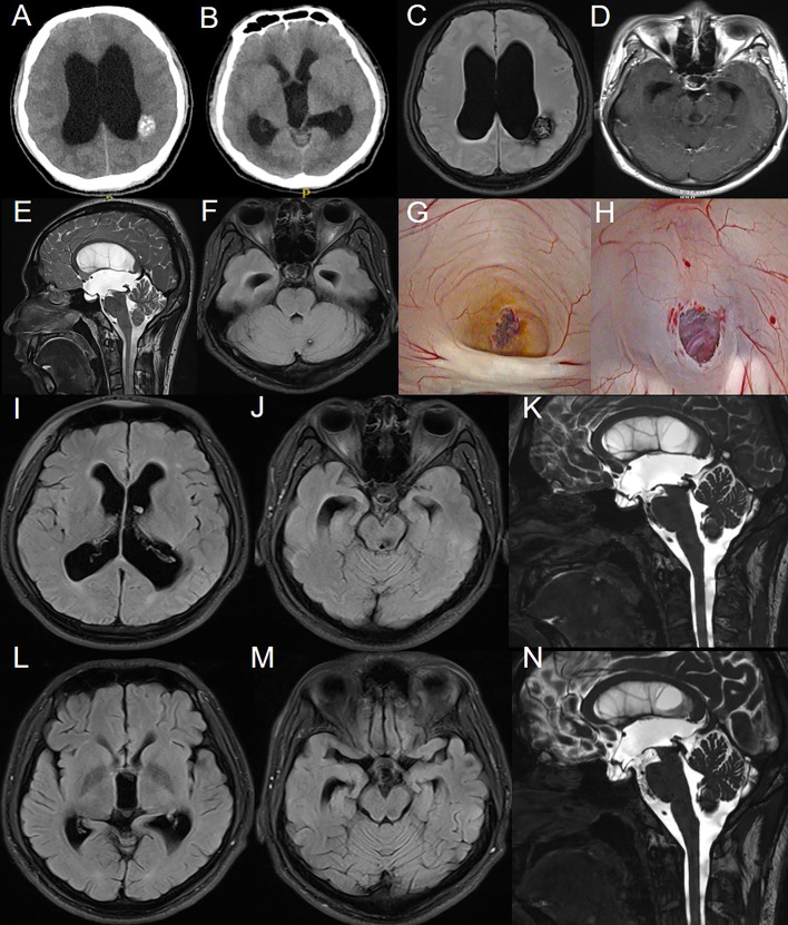 Figure 1