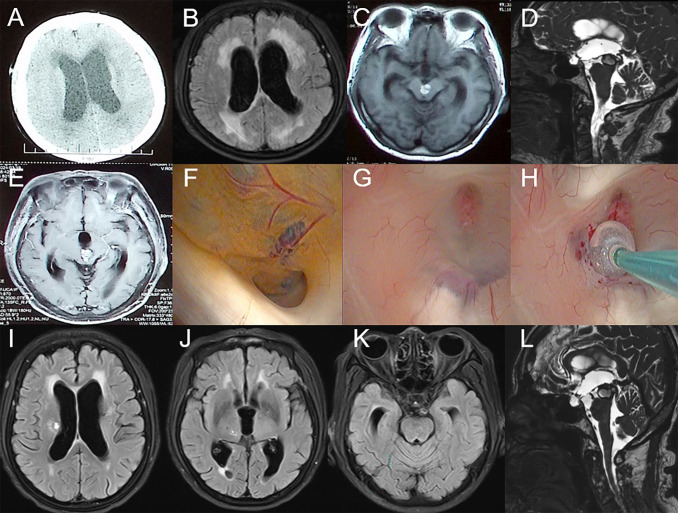 Figure 2