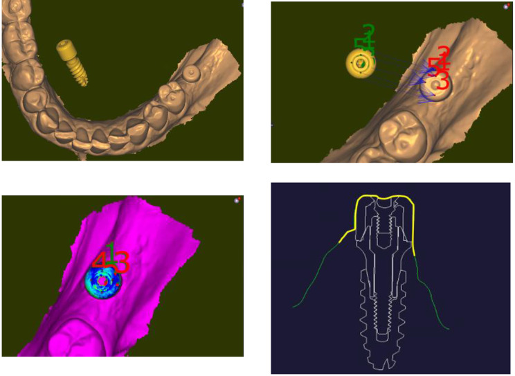 Figure 4