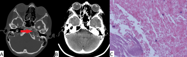 Figure 6