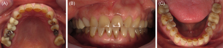 FIGURE 1
