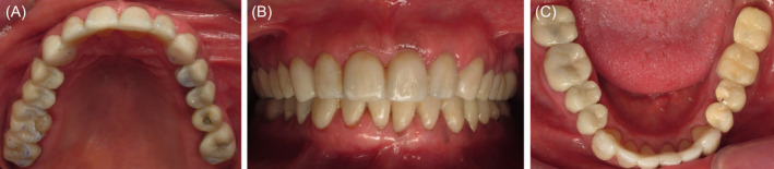 FIGURE 2