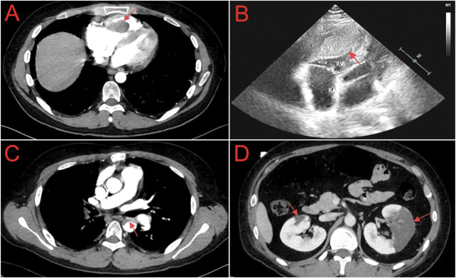 FIGURE 1