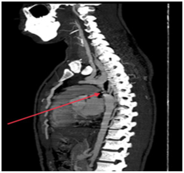 Figure 6