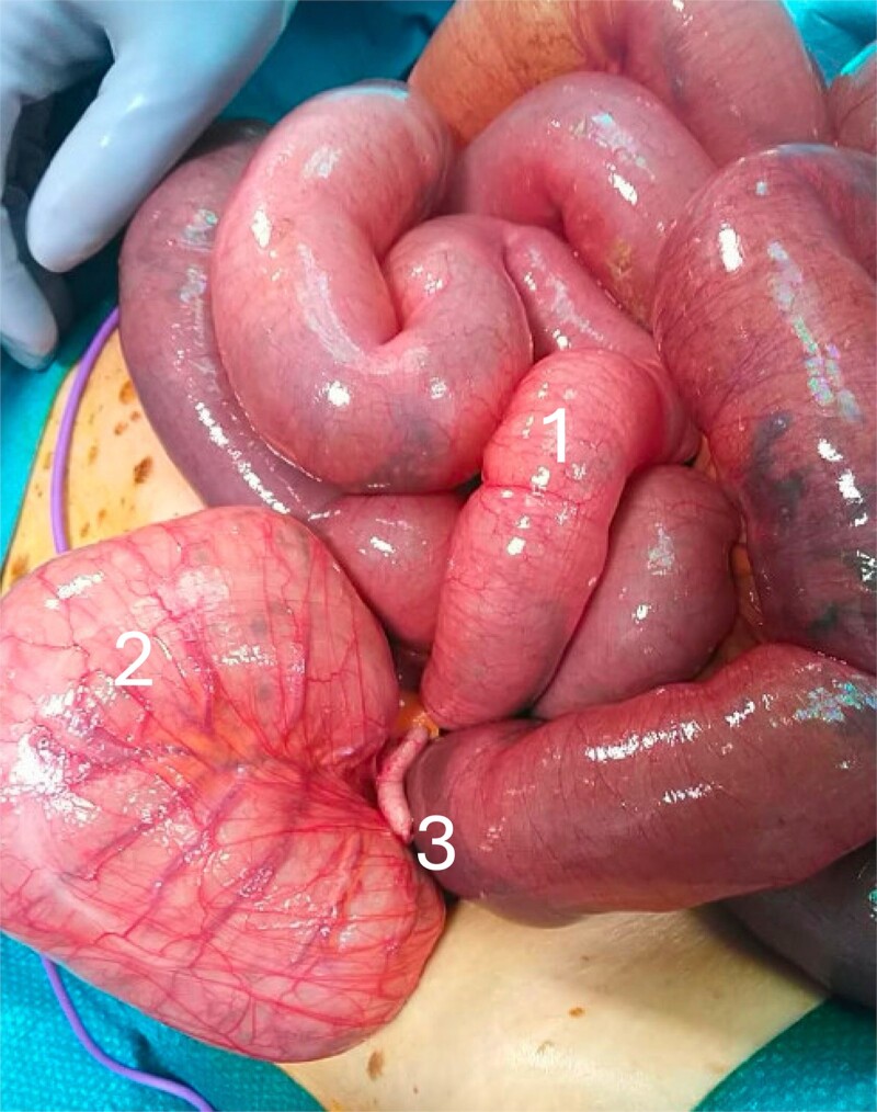 Figure 2