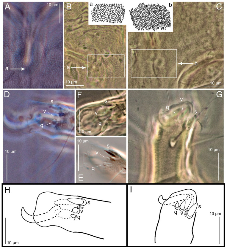 Figure 18
