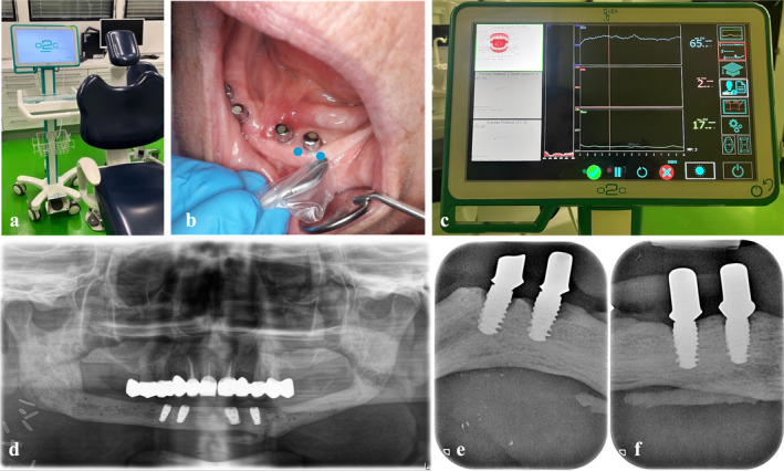 FIGURE 1