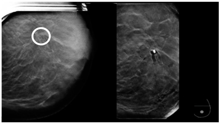 Figure 15