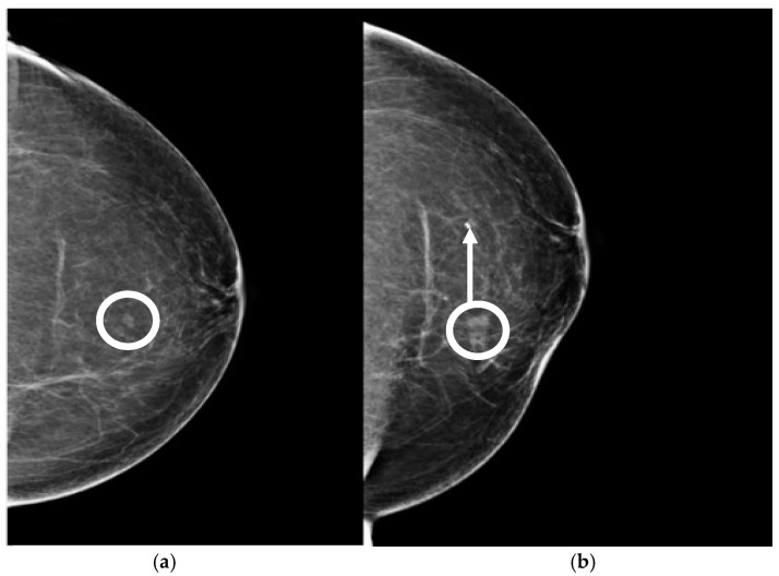 Figure 16