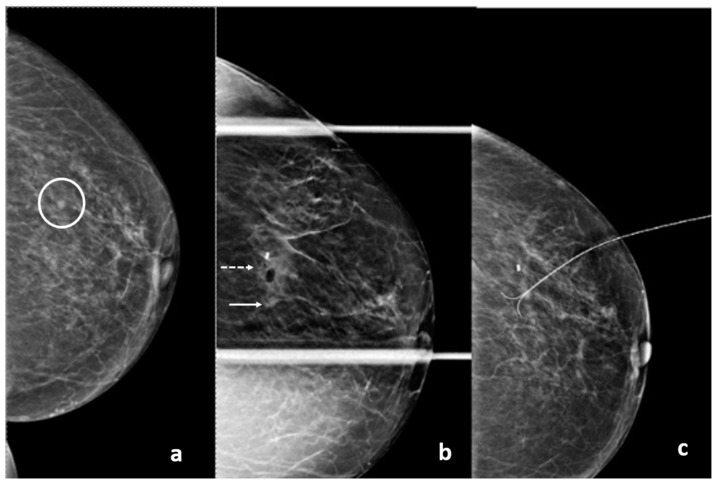 Figure 17