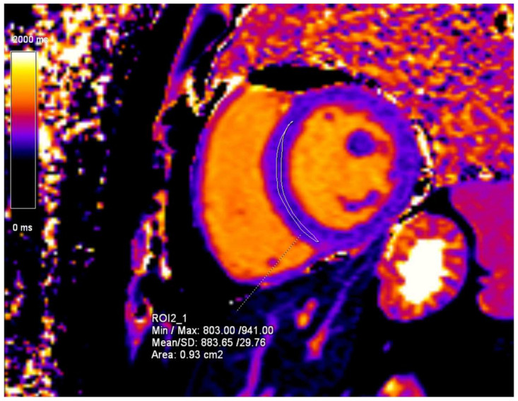 Figure 9