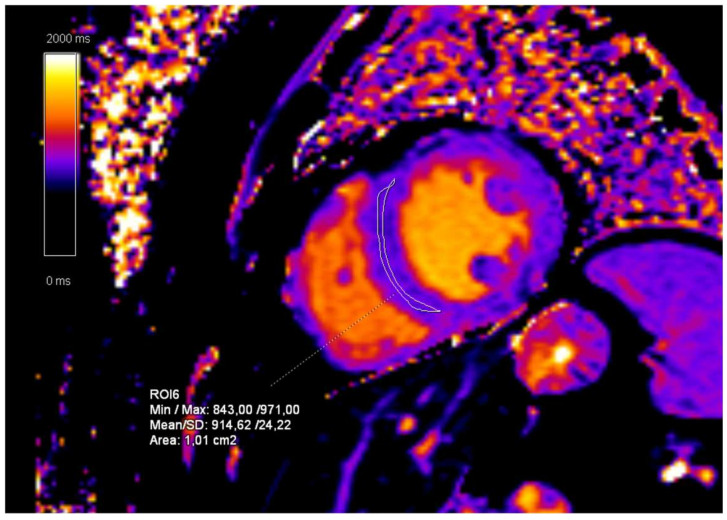 Figure 11