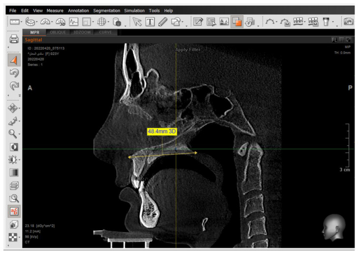 Figure 2