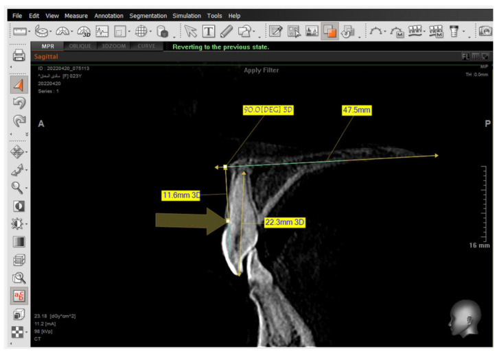Figure 6