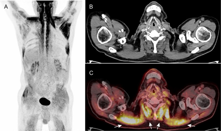 FIGURE 1