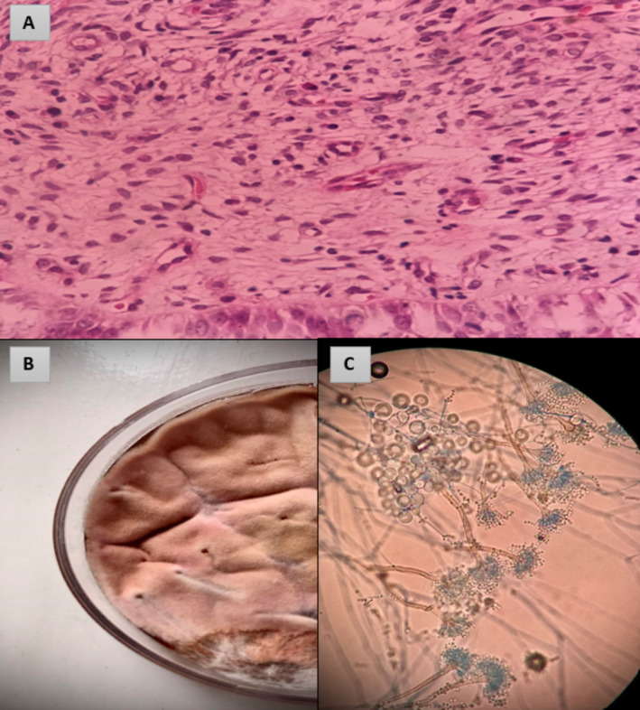 FIGURE 3