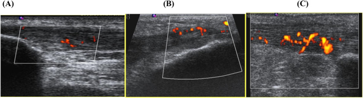 FIGURE 2