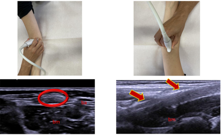 FIGURE 4