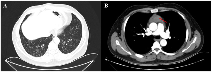 Figure 1