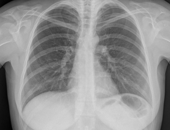 FIGURE 1