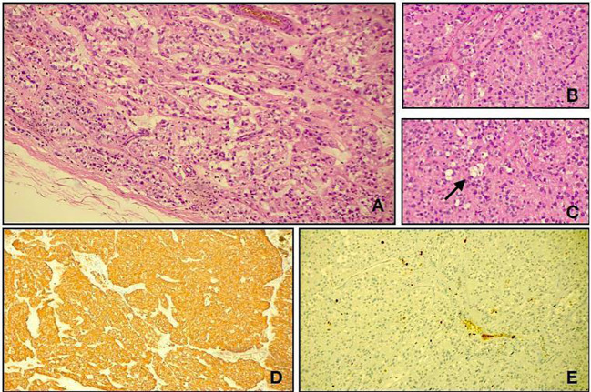 Figure 2