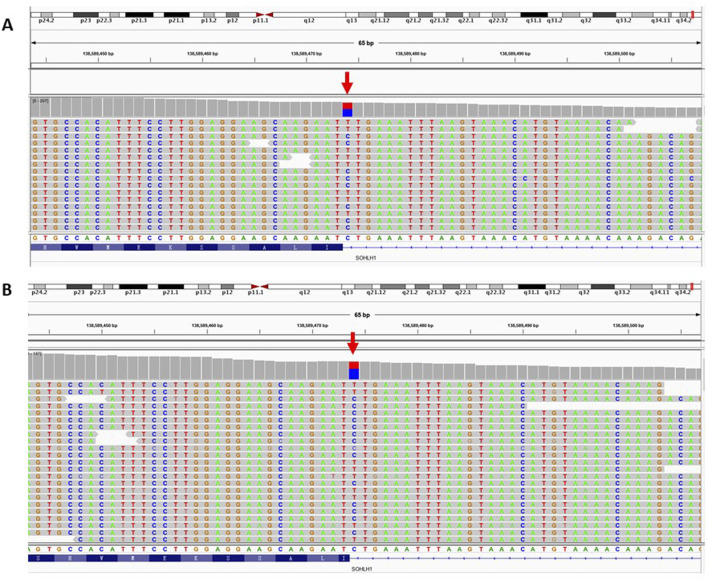 FIGURE 1