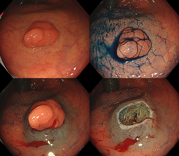 FIGURE 1