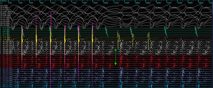 FIGURE 4