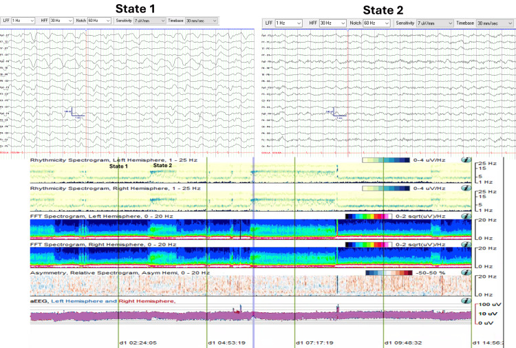 Figure 6
