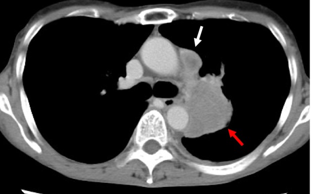 FIGURE 1