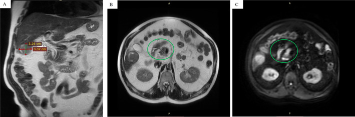 FIGURE 2