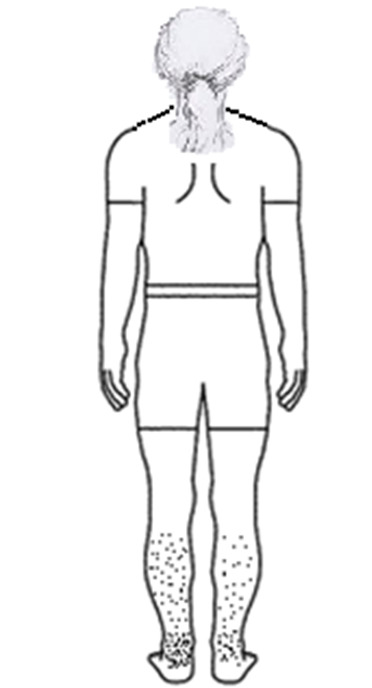 Figure-1