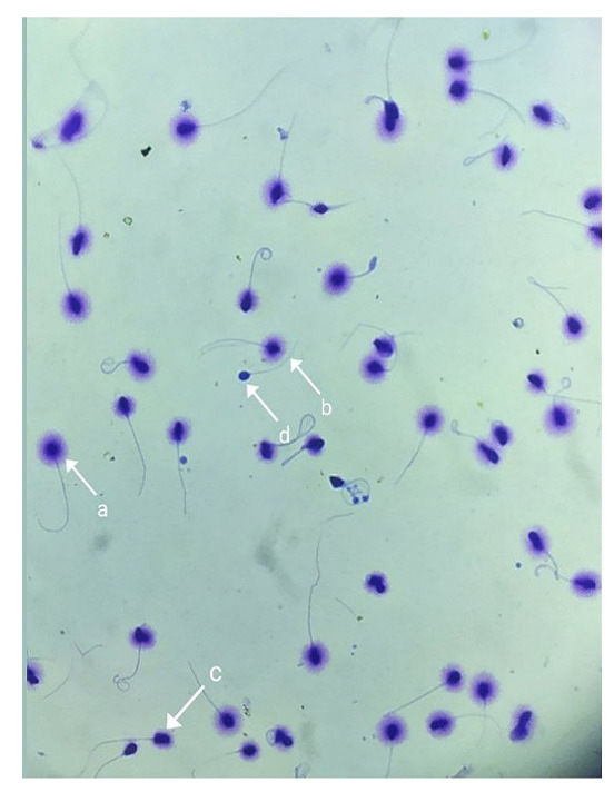 Figure-3