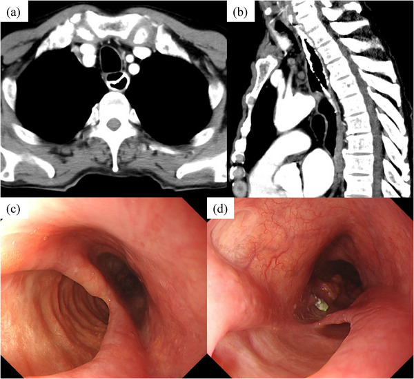 FIGURE 3