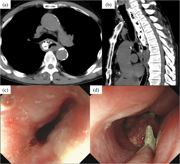 FIGURE 2