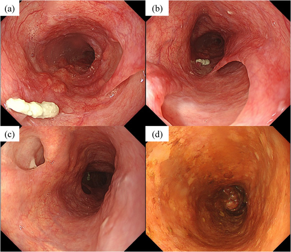 FIGURE 4