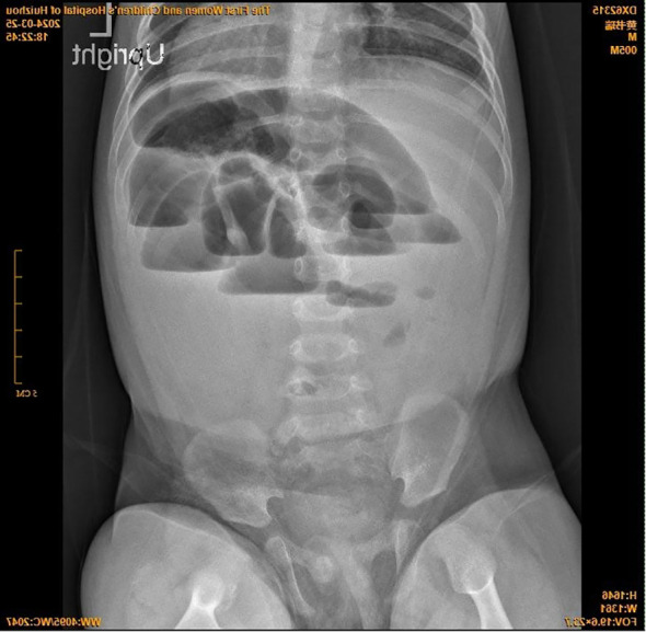 Figure 3