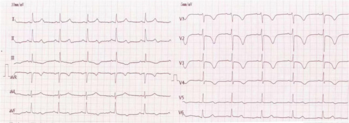 FIGURE 1