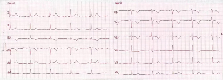 FIGURE 2