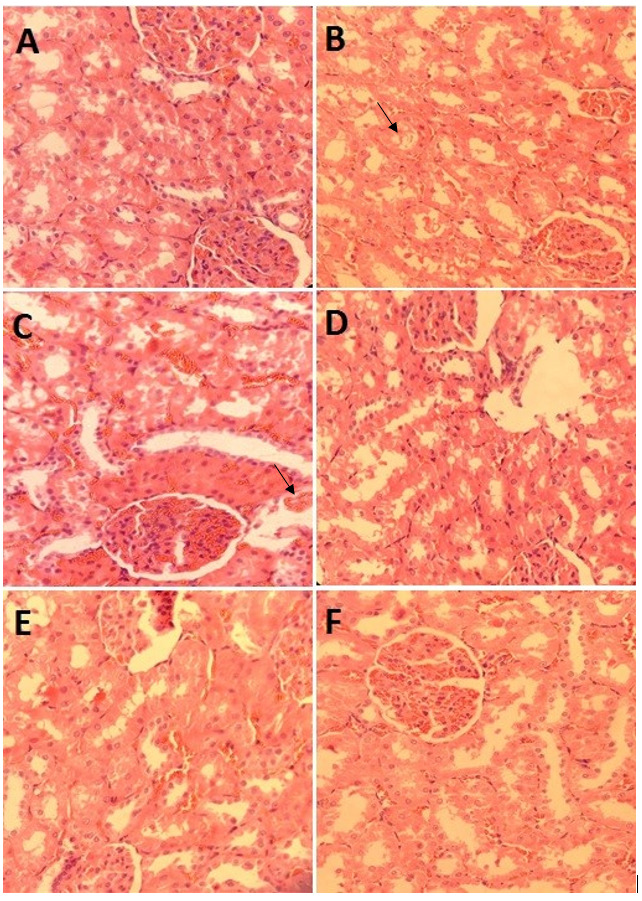 Figure-1