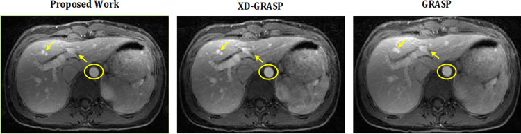 Fig 5